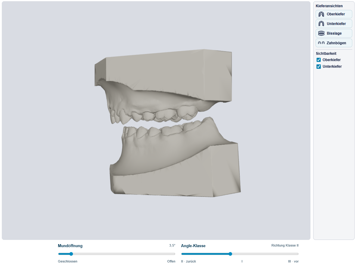 Freigegebenes 3D-Demomodell mit Kieferansichten sowie Bedienelementen für Mundöffnung und Angle-Klasse